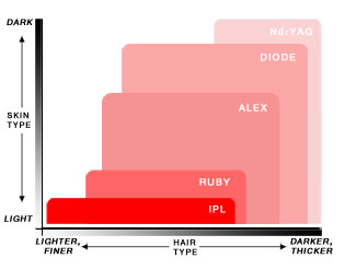 Laser Graph